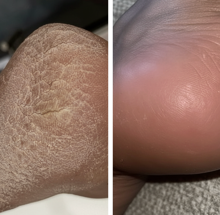 2. You'll See Noticeably Less Ashiness In As Little As 4 Weeks