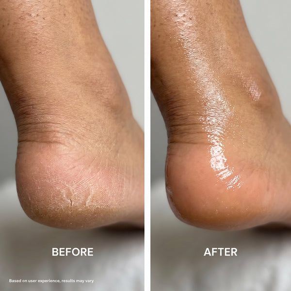 Feet finally glow!
