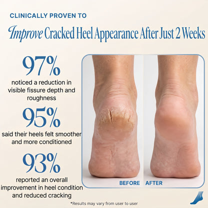 PureFoot Relief Stick - Heel Cracks