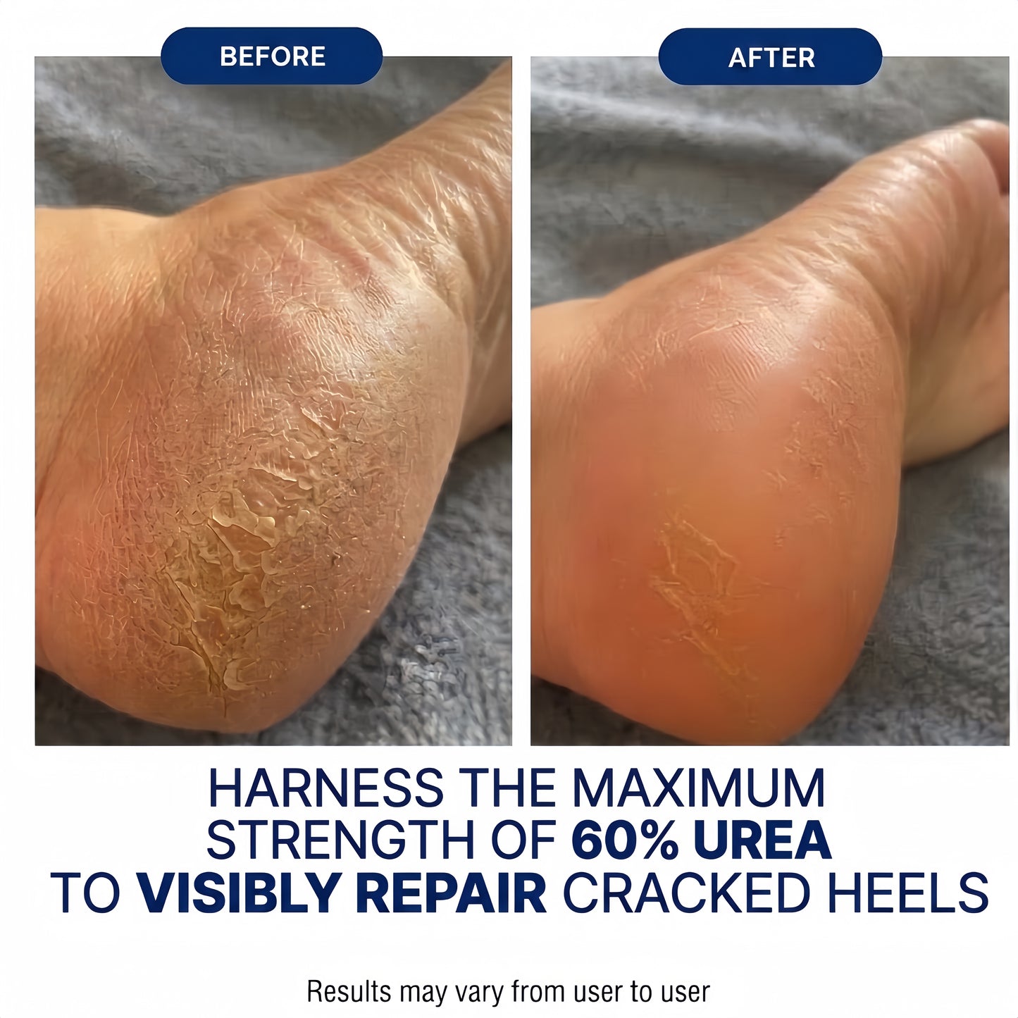 PureFoot Relief Stick - Heel Cracks