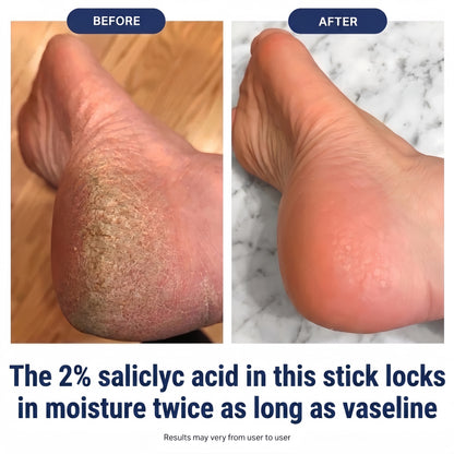 PureFoot Relief Stick - Heel Cracks