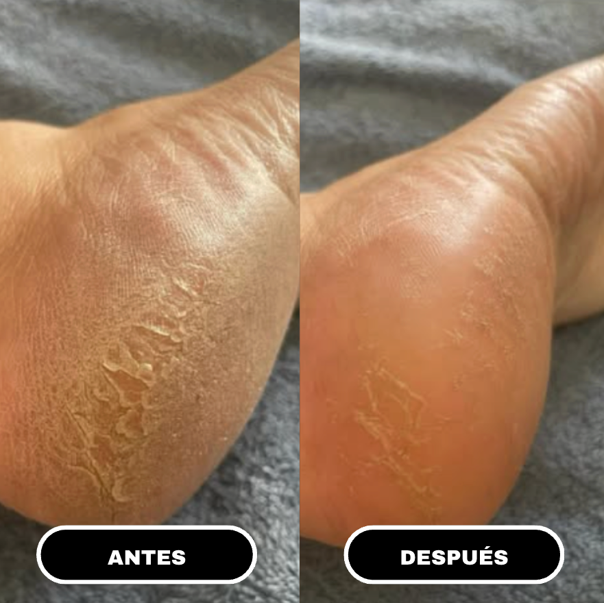 Urea Advanced Smooth Stick