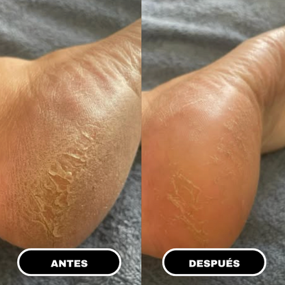 Urea Advanced Smooth Stick