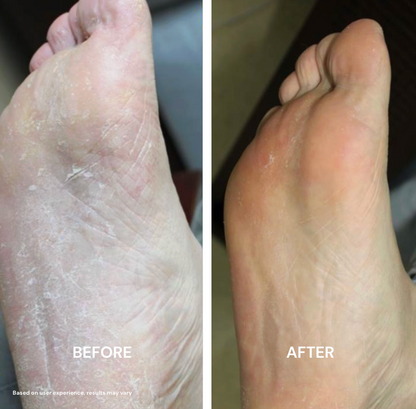 Urea Advanced Smooth Stick