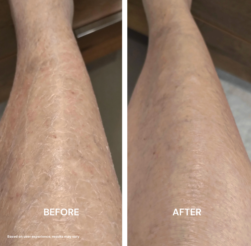 Urea Advanced Smooth Stick
