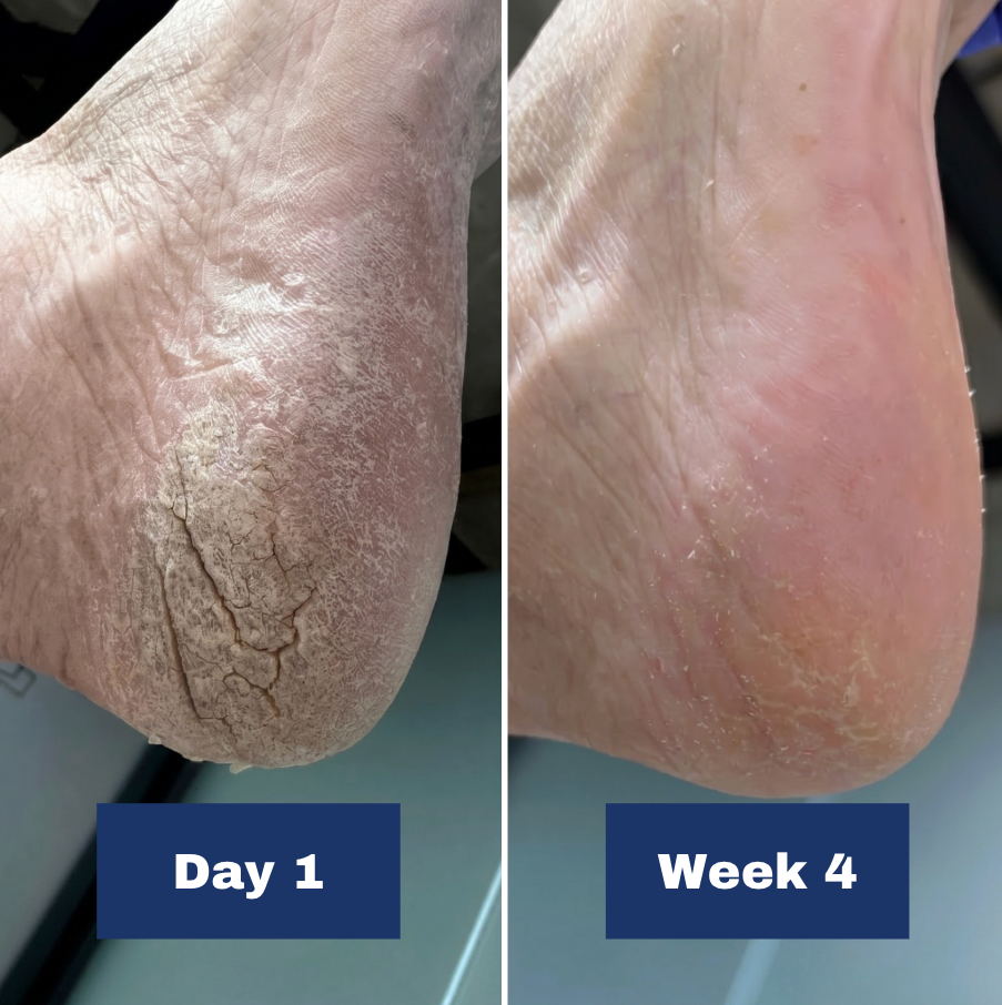 2. You'll See Noticeable Results In As Little As 4 Weeks